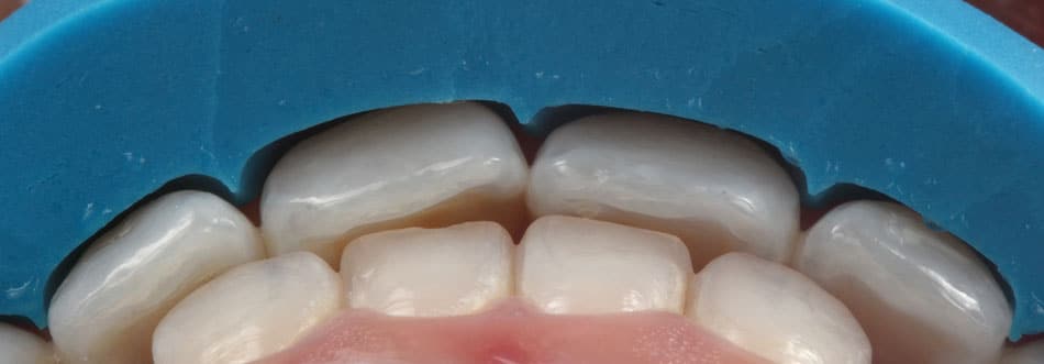 reanatomizações dentais